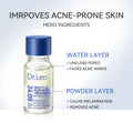 Salicylic Acid Acne Treatment Drying Lotion
