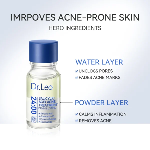 Salicylic Acid Acne Treatment Drying Lotion - Image 5
