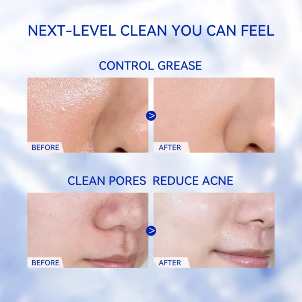 7X Ceramide Soothing Facial Cleanser - Image 6