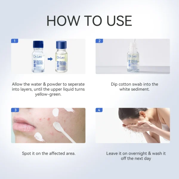 Salicylic Acid Acne Treatment Drying Lotion - Image 9